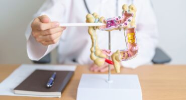 colonoscopy-myths-debunked